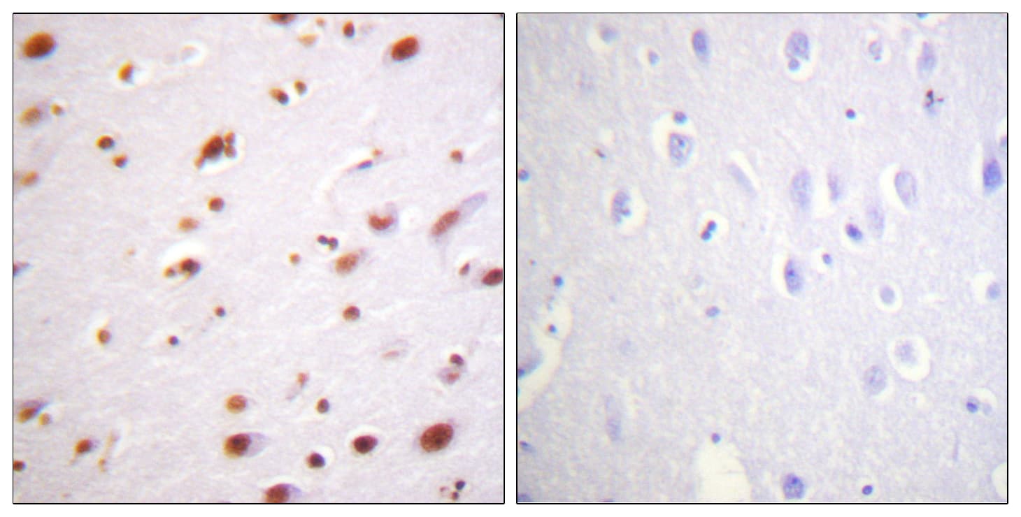 CTNND1 / p120 Catenin Antibody (phospho-Tyr228)