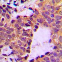 Polyclonal Rabbit anti-Human CTTN / Cortactin Antibody (phospho-Tyr466, IHC, IF, WB)