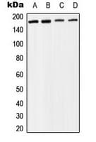 Polyclonal Rabbit anti-Human SMARCC2 Antibody (Internal, IF, WB)