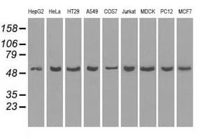 PPP5C Antibody (clone OTI2E12)
