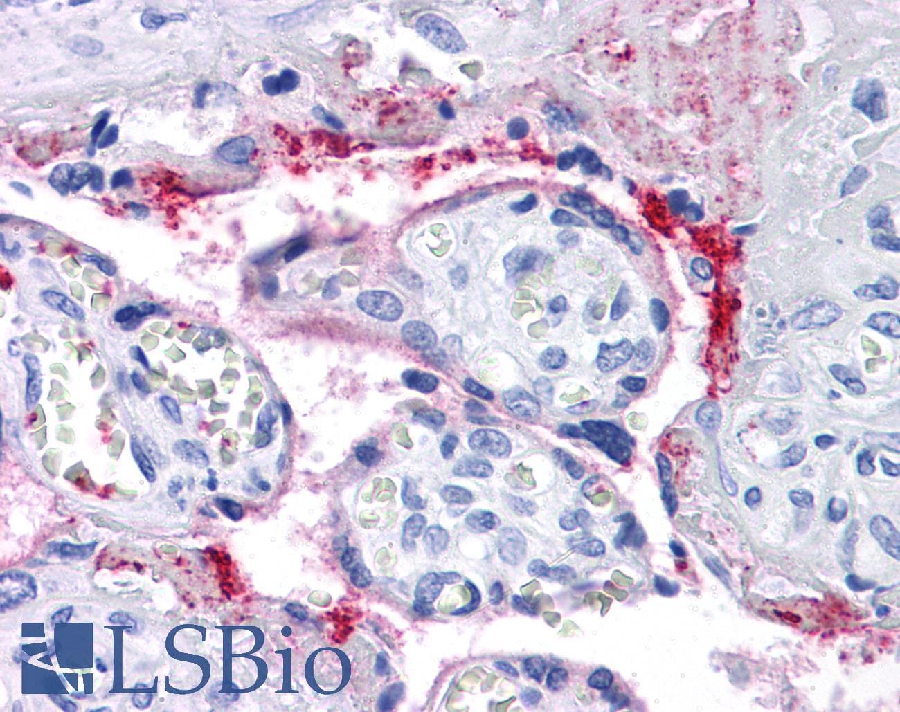 IHC-plus™ Monoclonal Mouse anti-Human ITGB3 / Integrin Beta 3 / CD61 Antibody (clone VI-PL2, IHC, WB)