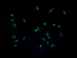 IHC-plus™ IL1F9 Antibody (clone 2F4)