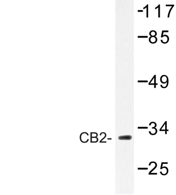 CNR2 / CB2 Antibody (Arg334)