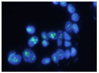 PathPlus™ NPM1 / NPM / Nucleophosmin Antibody (clone AT23F1)