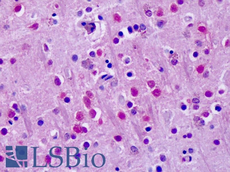 IHC-plus™ RORA / ROR Alpha Antibody (Hinge Domain)