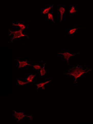 BMP12 / GDF7 Antibody
