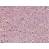LZTS3 Antibody