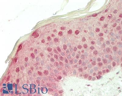 IHC-plus™ RIF1 Antibody (aa2425-C-term)