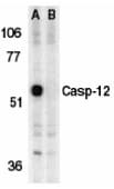 IHC-plus™ Polyclonal Rabbit anti-Human CASP12 / Caspase 12 Antibody (IHC, IF, WB)