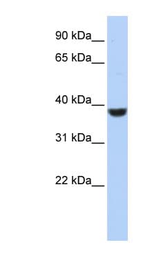 PPP1CA / PP1-Alpha Antibody (N-Terminus)