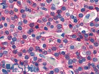 PathPlus™ CASR/Calcium Sensing Receptor Antibody (N-Terminus)