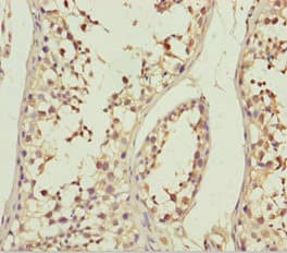 ABCB8 Antibody