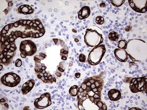 KRT7 / CK7 / Cytokeratin 7 Antibody (aa1-114, clone UMAB161)