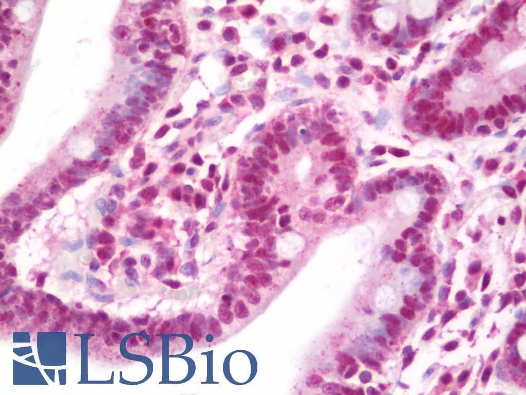 IHC-plus™ Polyclonal Rabbit anti-Human RAD23B / HR23B Antibody (aa359-409, IHC, IF)