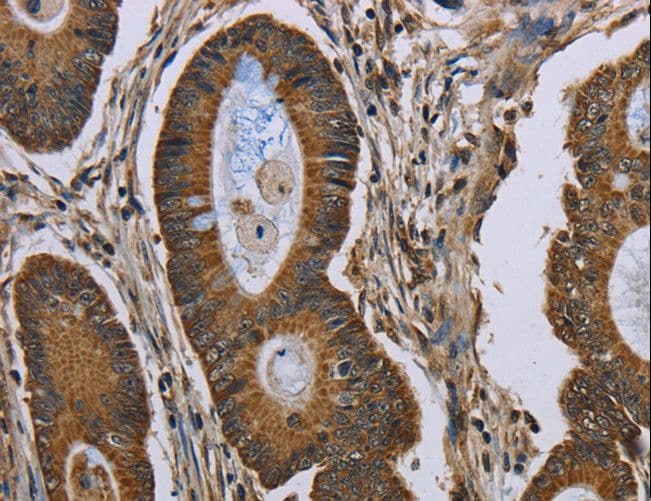 NEFH / NF-H Antibody