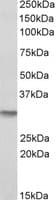 IHC-plus™ NQO1 Antibody (aa134-146)