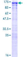 Human SFMBT1 Protein (Recombinant GST)