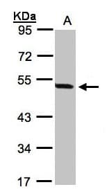 Polyclonal Rabbit anti-Human PAX8 Antibody (aa1-204, IHC, WB)
