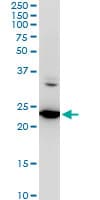 SEC22B Antibody (clone 5A10)