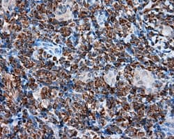 TPMT Antibody (clone OTI2A2)
