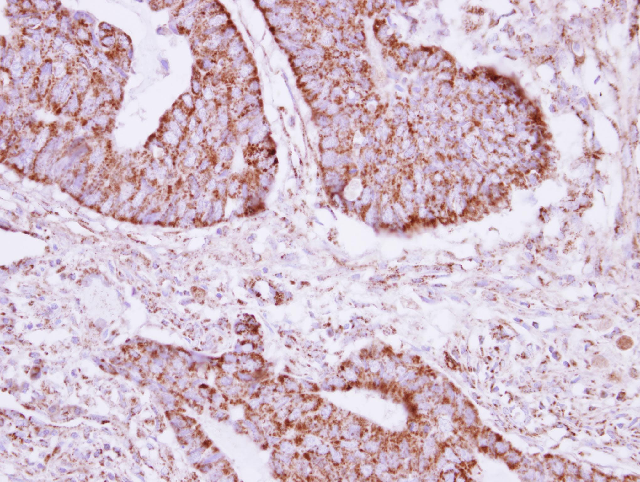 ACOT9 Antibody