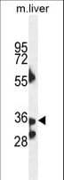 B3GNT4 Antibody (aa233-260)