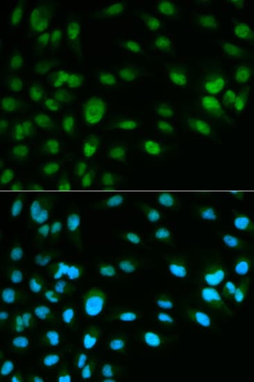 MCM7 Antibody