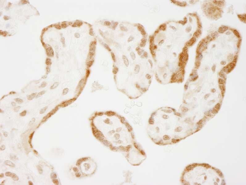 Polyclonal Rabbit anti-Human NELFE / RD / RDBP Antibody (aa330-380, IHC)