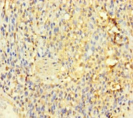 IL1RL2 Antibody