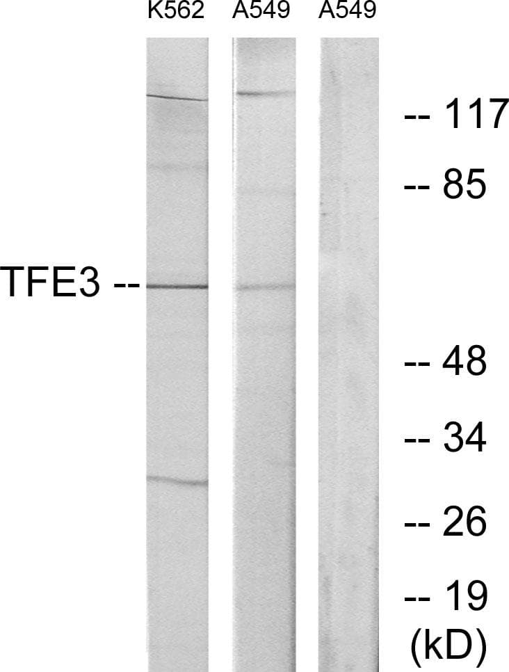 Polyclonal Rabbit anti-Human TFE3 Antibody (IHC, WB)