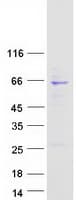 Human ABCE1 Protein (Recombinant Myc-DDK (Flag))