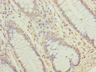 NUBPL Antibody