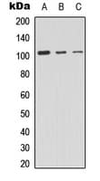 Polyclonal Rabbit anti-Human PRKD2 / PKD2 Antibody (C-Terminus, IHC, WB)