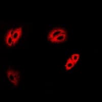 RBP3 / IRBP Antibody