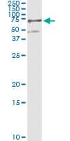 PGM3 Antibody (clone 1E2-1B12)