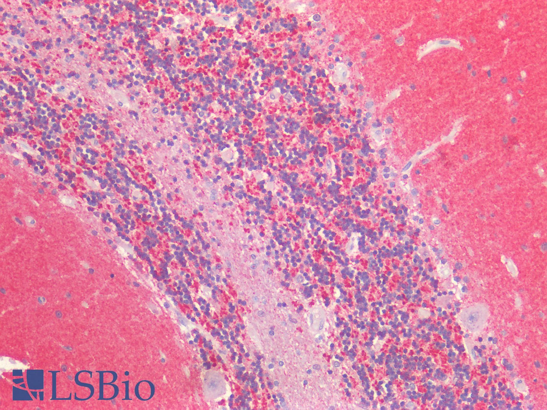 PathPlus™ SNCA / Alpha-Synuclein Antibody