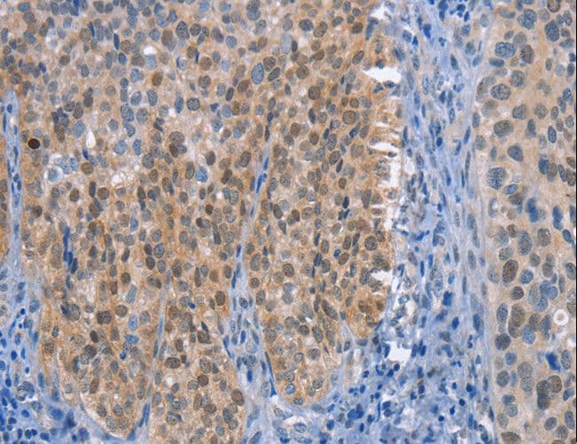 UCK1 Antibody