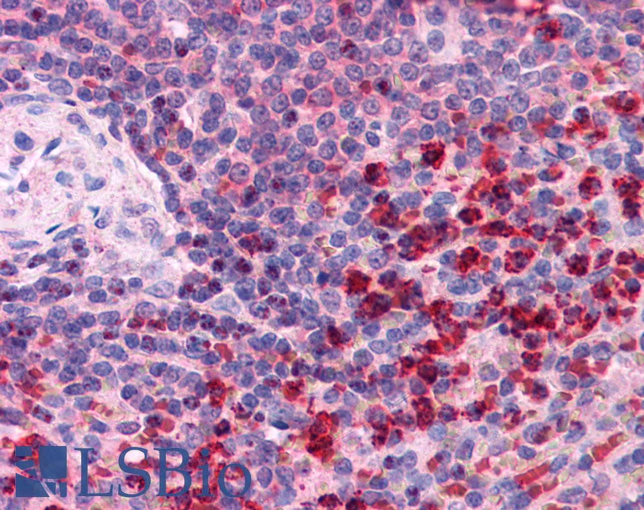 IHC-plus™ TRXR1 / TXNRD1 Antibody (aa600-612)
