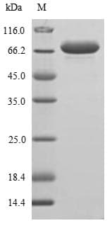 Peanut Allergen Ara h 1 Protein (Recombinant 10His, N-terminus)