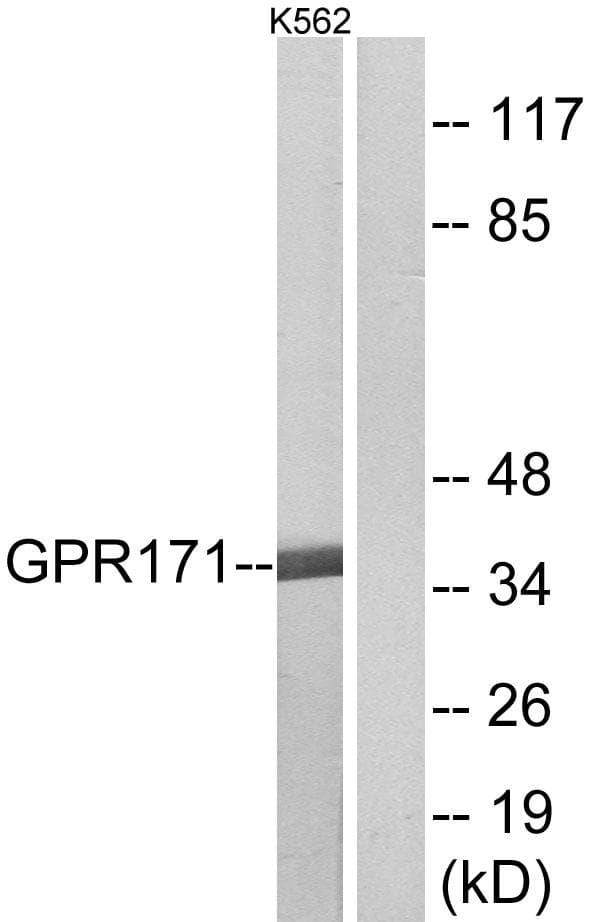 Polyclonal Rabbit anti-Human GPR171 Antibody (IF, WB)