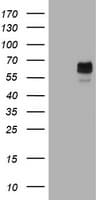 Monoclonal Mouse anti-Human Tyrosinase Antibody (clone OTI1F3, IHC, WB)