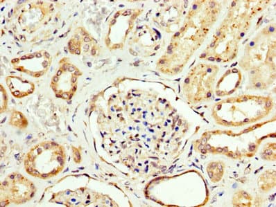 Polyclonal Rabbit anti-Human CPT2 Antibody (IHC)