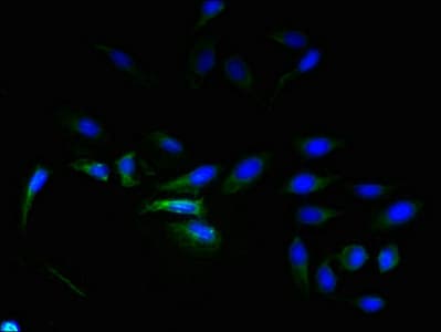 ADGRL4 / ELTD1 Antibody (aa85-299)