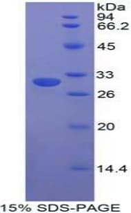 Human STAMBP / AMSH Protein (Recombinant His-T7)
