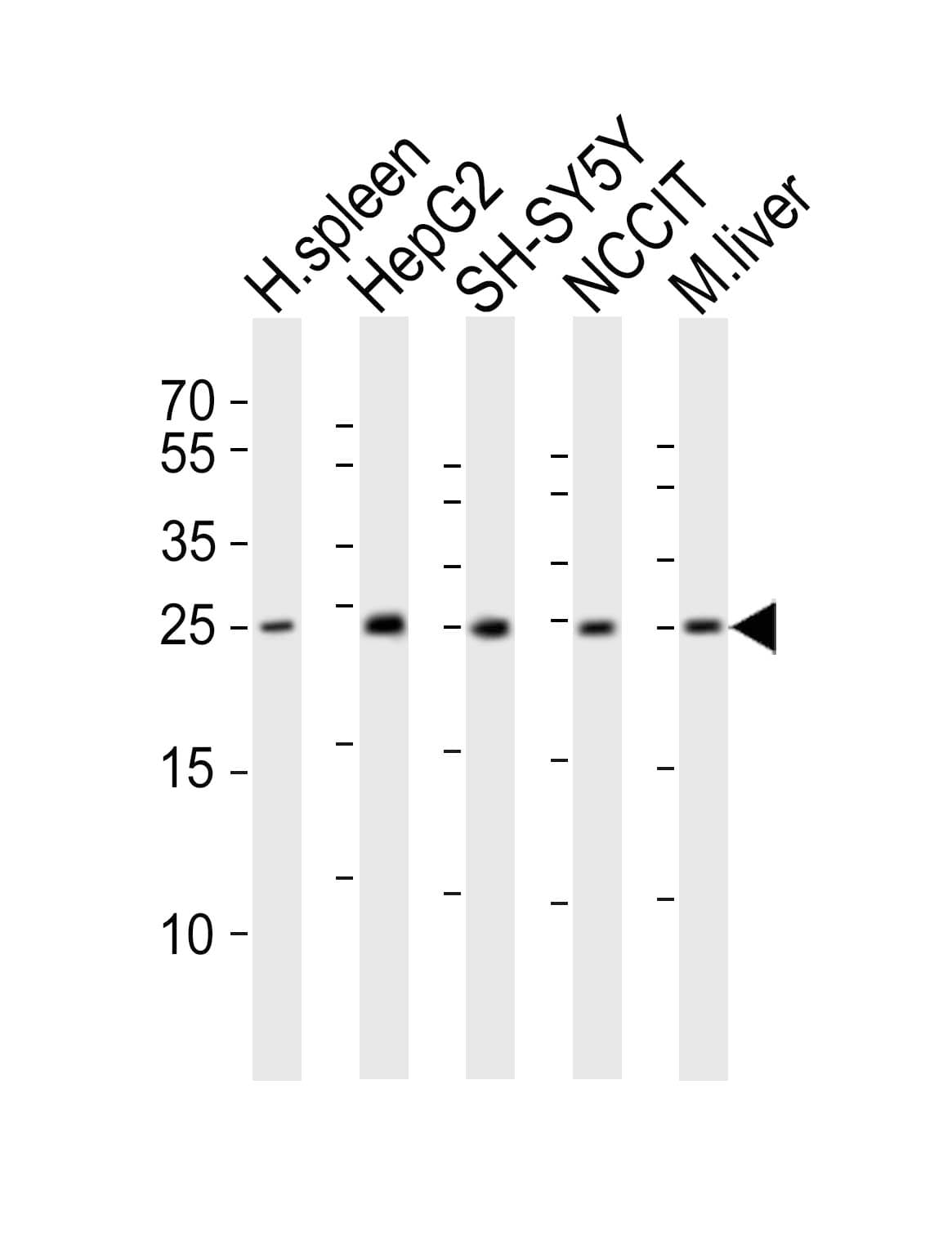 MIXL1 / MIXL Antibody (aa183-218)