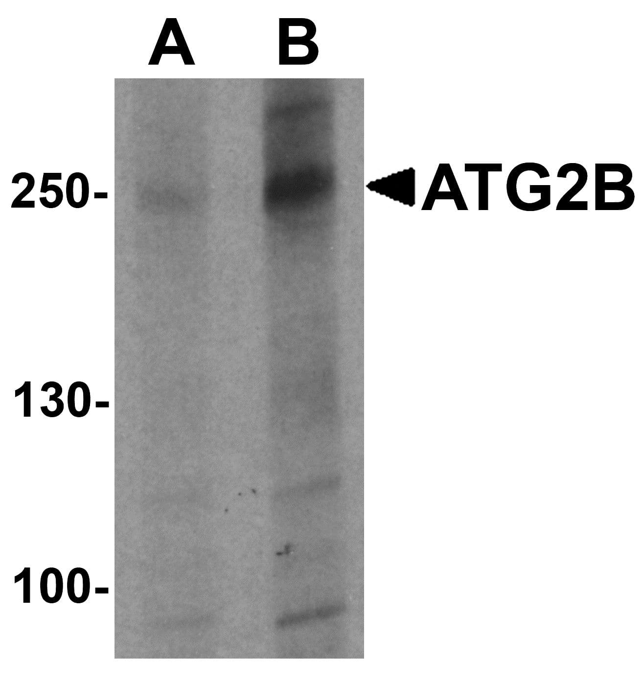 IHC-plus™ Polyclonal Rabbit anti-Human ATG2B Antibody (IHC, IF, WB)
