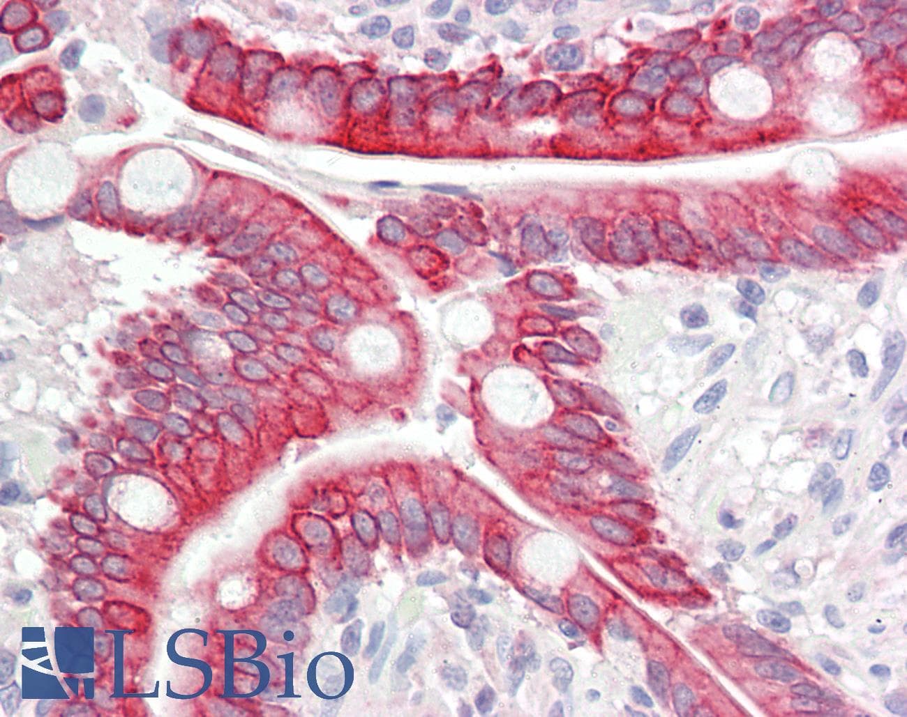 IHC-plus™ IARS2 Antibody (aa71-120)
