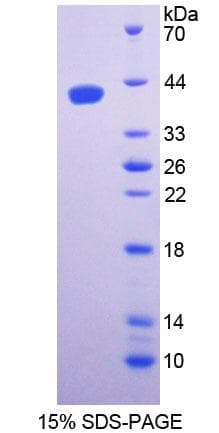 Mouse SPTLC1 / HSN1 Protein (Recombinant His-T7)