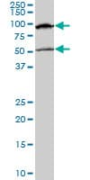 IHC-plus™ MECP2 Antibody (clone 4B6)