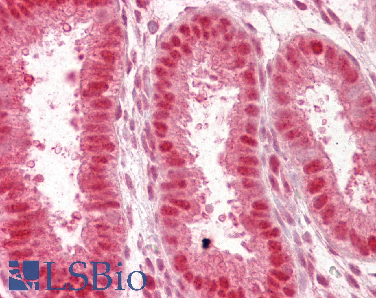 IHC-plus™ Polyclonal Goat anti-Human NUP50 Antibody (aa429-440, IHC, WB)